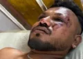 എയറിന്ത്യ വിമാനാപകടത്തില്‍ നിന്നും രക്ഷപ്പെട്ട 11എ സീറ്റിലെ യാത്രക്കാരനായ വിശ്വാസ് കുമാര്‍ രമേഷ്.