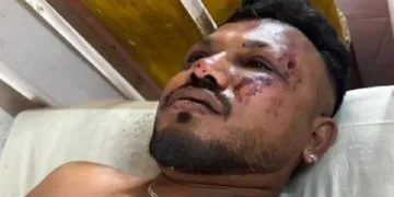 എയറിന്ത്യ വിമാനാപകടത്തില്‍ നിന്നും രക്ഷപ്പെട്ട 11എ സീറ്റിലെ യാത്രക്കാരനായ വിശ്വാസ് കുമാര്‍ രമേഷ്.
