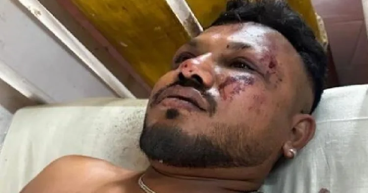 എയറിന്ത്യ വിമാനാപകടത്തില്‍ നിന്നും രക്ഷപ്പെട്ട 11എ സീറ്റിലെ യാത്രക്കാരനായ വിശ്വാസ് കുമാര്‍ രമേഷ്.