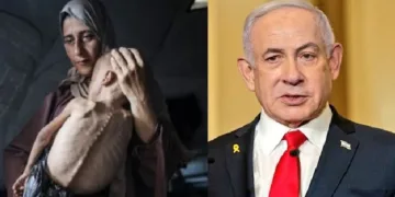 ജനിതകരോഗം മൂലം ശരീരം ശോഷിച്ച് എല്ലുന്തിയ ഈ കുട്ടിയെ ഇസ്രയേല്‍ യുദ്ധം മൂലം ഭക്ഷണം കിട്ടാതെ പട്ടിണിമൂലം ശോഷിച്ച കുട്ടിയാണെന്ന് പറഞ്ഞ് ന്യൂയോര്‍ക്ക് ടൈംസ് പ്രസിദ്ധീകരിച്ച വ്യാജഫോട്ടോ (ഇടത്ത്)