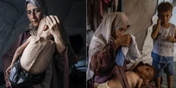 ഉമ്മയുടെ മാറില്‍ ചേര്‍ന്നു കിടക്കുന്ന മാംസ പേശി ക്ഷയിക്കുന്ന ജനിതകരോഗമുള്ള കുട്ടിയെ ഇസ്രയേല്‍ അതിക്രമം മൂലം ഭക്ഷണം കിട്ടാതെ എല്ലും തോലുമായി കുട്ടിയാക്കി അവതരിപ്പിച്ച ന്യൂയോര്‍ക്ക് ടൈംസ്.(ഇടത്ത്) ഉമ്മ മാറോട് ചേര്‍ത്ത് പിടിച്ച ശരീരം ശോഷിക്കുന്ന രോഗമുള്ള ഇളയ കുട്ടിയും അവരുടെ തന്നെ രോഗമില്ലാത്ത മൂത്ത മകനും നില്‍ക്കുന്ന യഥാര്‍ത്ഥ ചിത്രം. ന്യൂയോര്ക്ക് ടൈംസിന്‍റെ ഇസ്രയേലിനെ പ്രതിക്കൂട്ടിലാക്കുന്ന കള്ളം പൊളിച്ചുകളയുന്നതായിരുന്നു ഈ ചിത്രം (വലത്ത്)