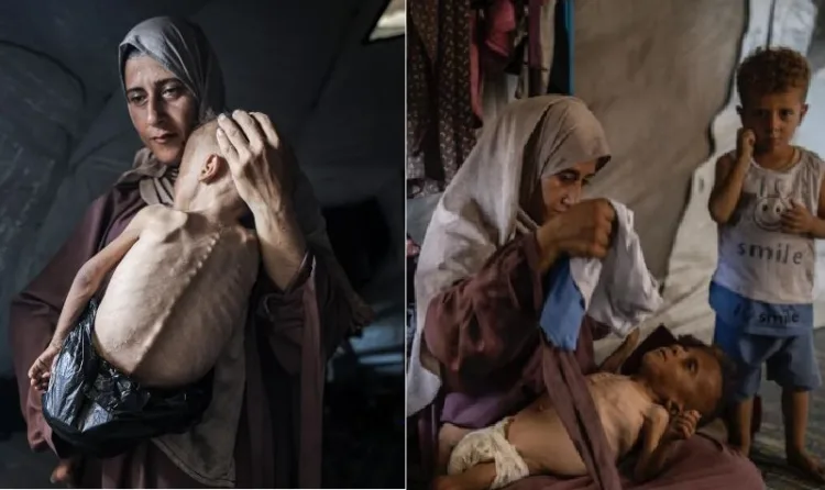 ഉമ്മയുടെ മാറില്‍ ചേര്‍ന്നു കിടക്കുന്ന മാംസ പേശി ക്ഷയിക്കുന്ന ജനിതകരോഗമുള്ള കുട്ടിയെ ഇസ്രയേല്‍ അതിക്രമം മൂലം ഭക്ഷണം കിട്ടാതെ എല്ലും തോലുമായി കുട്ടിയാക്കി അവതരിപ്പിച്ച ന്യൂയോര്‍ക്ക് ടൈംസ്.(ഇടത്ത്) ഉമ്മ മാറോട് ചേര്‍ത്ത് പിടിച്ച ശരീരം ശോഷിക്കുന്ന രോഗമുള്ള ഇളയ കുട്ടിയും അവരുടെ തന്നെ രോഗമില്ലാത്ത മൂത്ത മകനും നില്‍ക്കുന്ന യഥാര്‍ത്ഥ ചിത്രം. ന്യൂയോര്ക്ക് ടൈംസിന്‍റെ ഇസ്രയേലിനെ പ്രതിക്കൂട്ടിലാക്കുന്ന കള്ളം പൊളിച്ചുകളയുന്നതായിരുന്നു ഈ ചിത്രം (വലത്ത്)