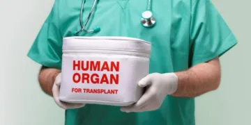 Organ transplantation