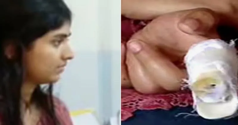 കൈക്ക് പരിക്കേറ്റ അക്ഷരയ്ക്ക് വോട്ട് ചെയ്യാന് കഴിഞ്ഞത് മണിക്കൂറുകളുടെ കാത്തിരിപ്പിനും പ്രതിഷേധത്തിനും ശേഷം