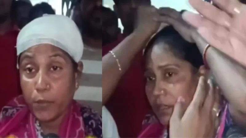 ബിജെപിക്കാർ ആക്രമിച്ചെന്ന് പറഞ്ഞ് മേയ്‌ക്കപ്പിട്ടെത്തി തൃണമൂൽ പ്രവർത്തക ; ബാൻഡേജ് എടുത്ത് മാറ്റി......