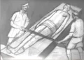 അടിയന്തരാവസ്ഥക്കാലത്തെ ക്രൂര പീഡനങ്ങളിലൊന്ന്‌