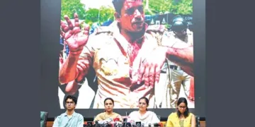 പരിക്കേറ്റ പോലീസുകാരുടെ ചിത്രങ്ങള്‍ പ്രദര്‍ശിപ്പിച്ച് കുടംബാംഗങ്ങള്‍ നടത്തിയ വാര്‍ത്താസമ്മേളനം